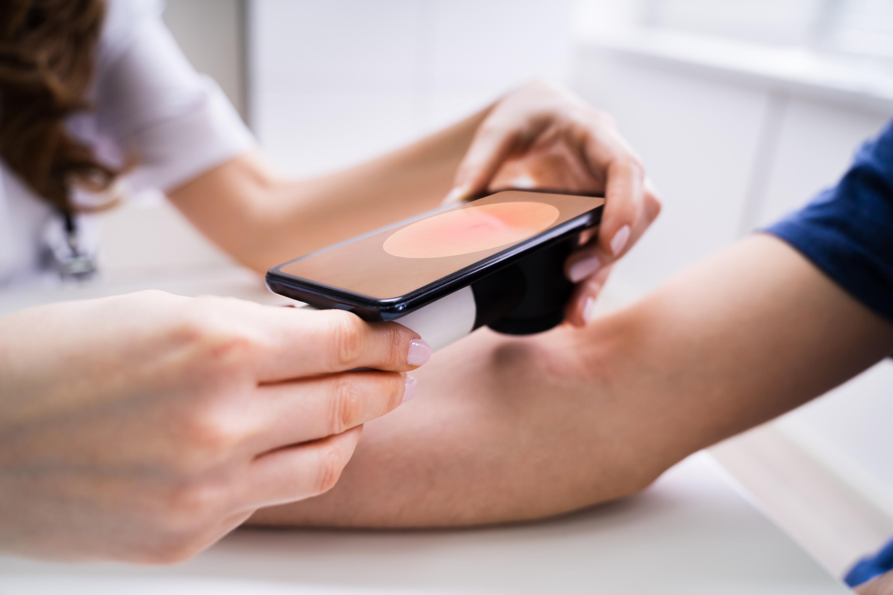 Eczema nummulare sull’avambraccio